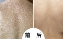 重庆西南医院挂号