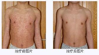 重庆西南医院挂号