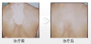 重庆西南医院皮肤科