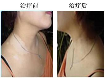 重庆皮肤病医院,重庆皮肤病医院哪家好_排名_怎么样_地址电话