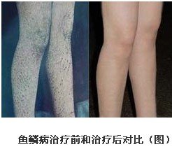 重庆西南医院皮肤科