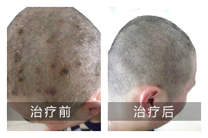 重庆市西南医院皮肤专科治疗好吗