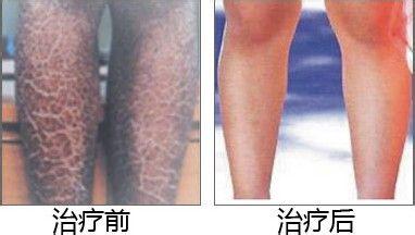 重庆西南医院挂号