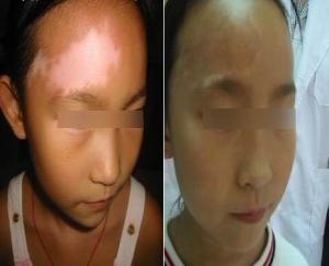 重庆皮肤病医院,重庆皮肤病医院哪家好_排名_怎么样_地址电话