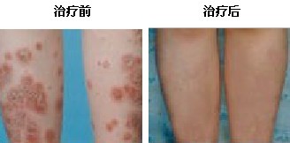 重庆西南医院在网上挂号的地址
