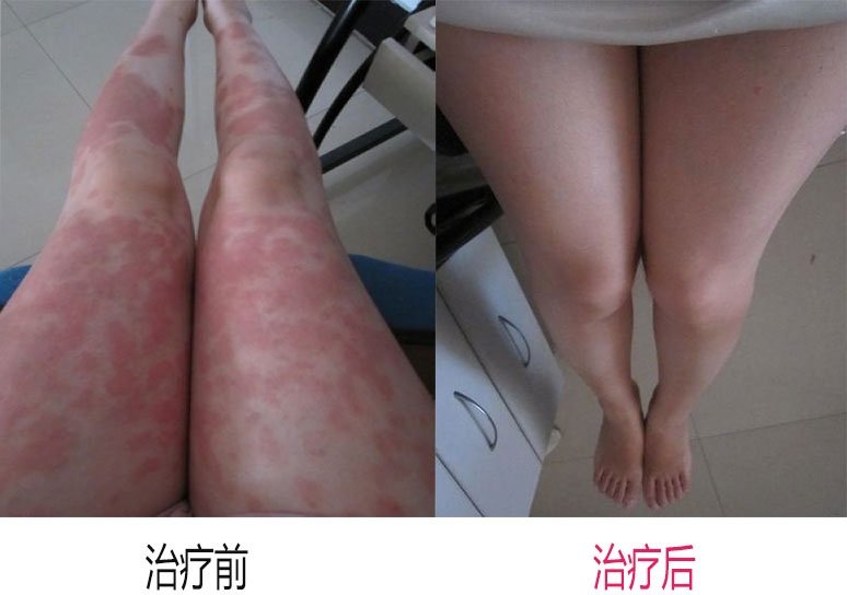 重庆西南医院网上预约快吗