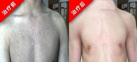 重庆皮肤病医院,重庆皮肤病医院哪家好_排名_怎么样_地址电话